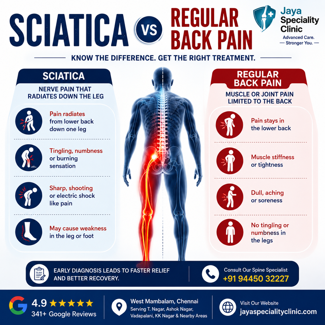 Sciatica vs. Regular Back Pain: How to Tell the Difference